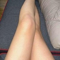 银屑病患者该如何应对