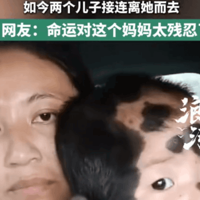 男童九成兽皮痣癌变离世