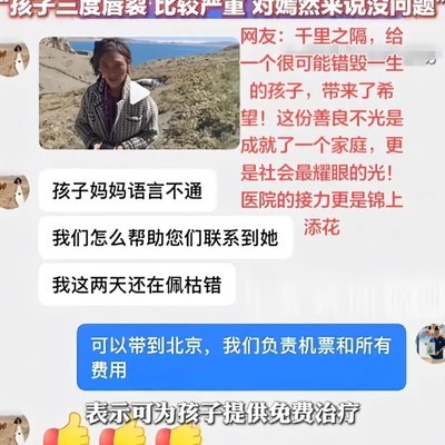 藏区唇腭裂儿童获嫣然医院火速回应