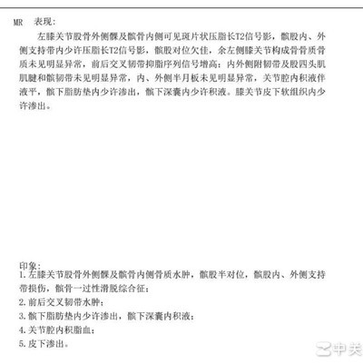 髌骨脱位治疗经验分享