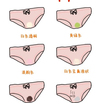 白带颜色医学图解