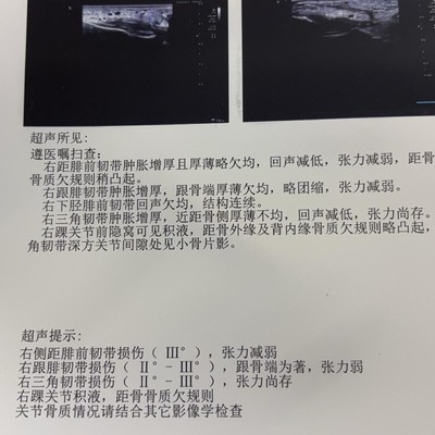 研究生遭遇运动伤，韧带断裂如何应对