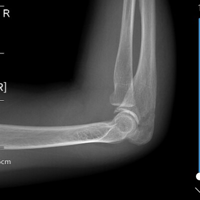 医生讨论看片技巧