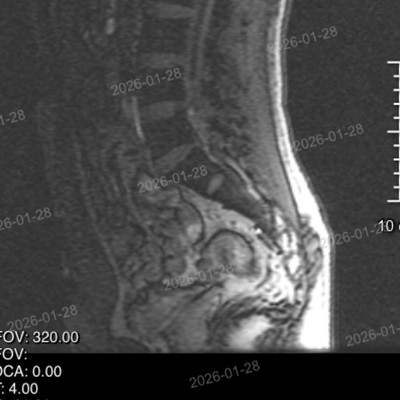 骨科医生帮忙看下