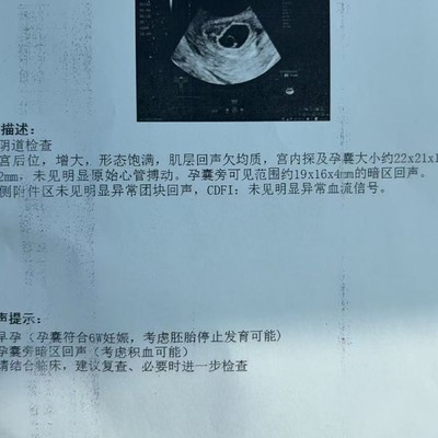 孕6周胎停，如何走出心理阴影