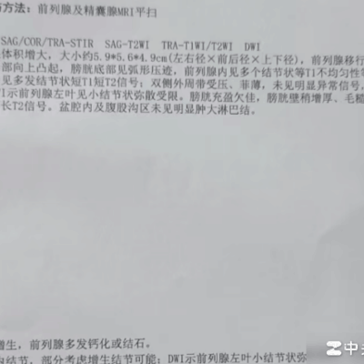 婚姻中的亲密边界探讨