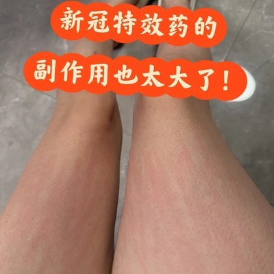 先诺欣致夜间剧痒