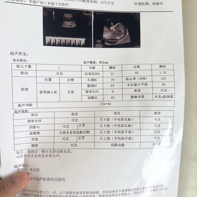 帮看宝宝性别
