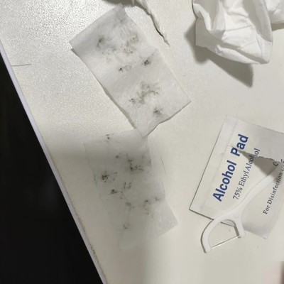 手机充电口清灰妙招